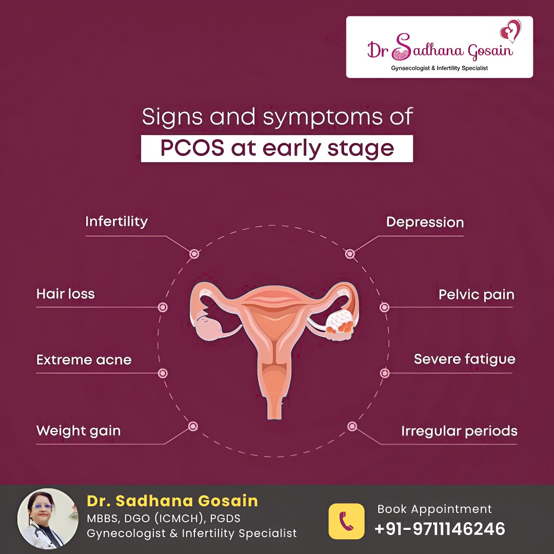 Early Signs of PCOS You Shouldn’t Ignore!