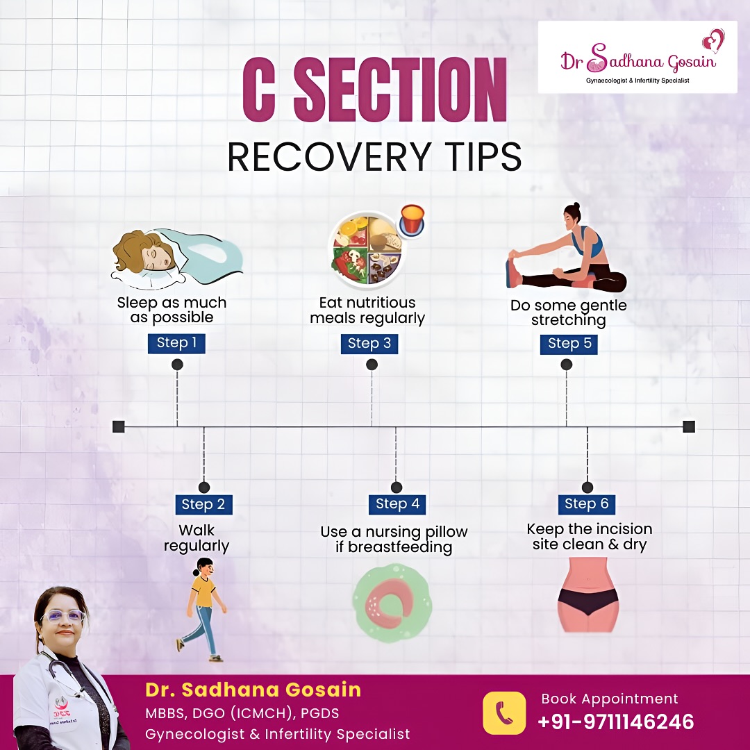 Recovering from a C-section?