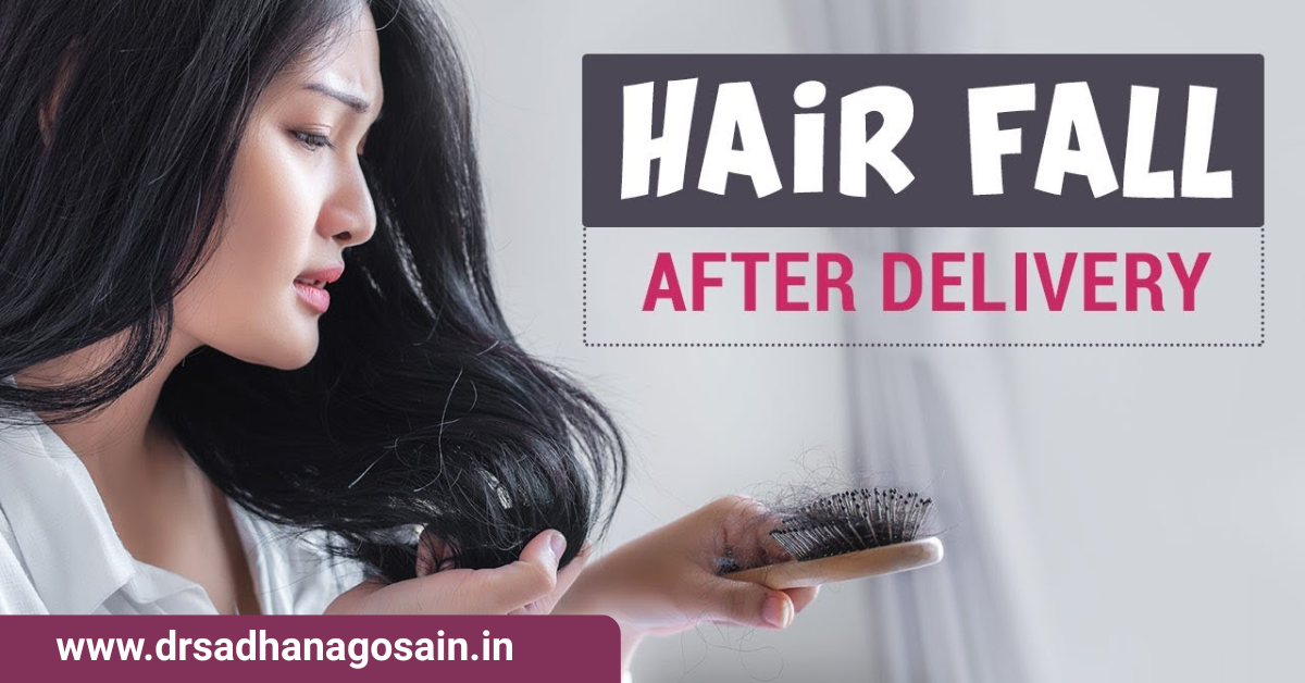 Hair Fall After Delivery – Postpartum Hair Loss Guide
