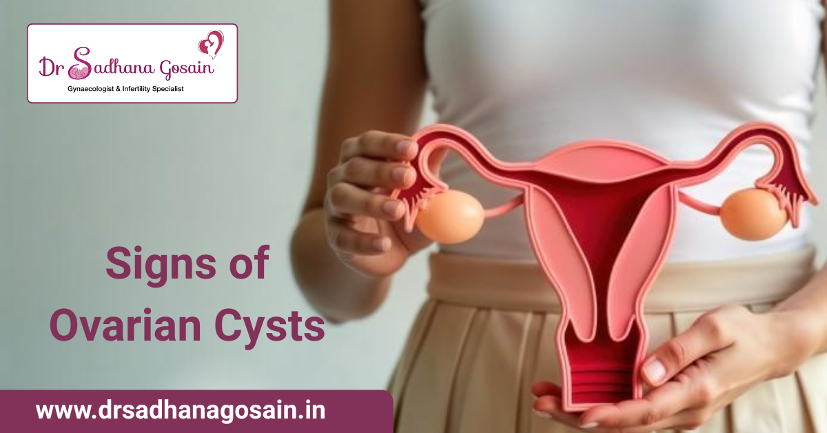 Signs of Ovarian Cysts: What Every Woman Should Know