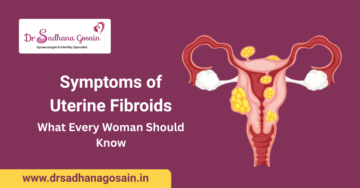 Symptoms of Uterine Fibroids: What Every Woman Should Know